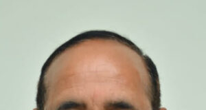 समाज सेवी संस्थाओं के सहयोग से बनाई गई हैँ विभिन्न टीमें